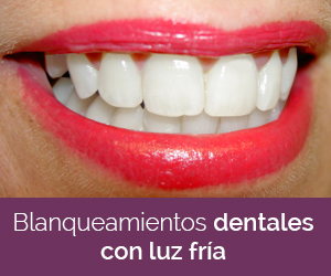 Blanqueamientos dentales